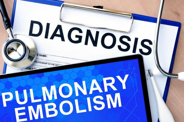 Caregiver in Carmichael CA: What is a Pulmonary Embolism?