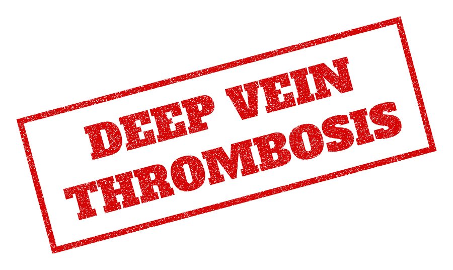 Home Care in Rancho Cordova CA: Preventing Deep Vein Thrombosis After Surgery