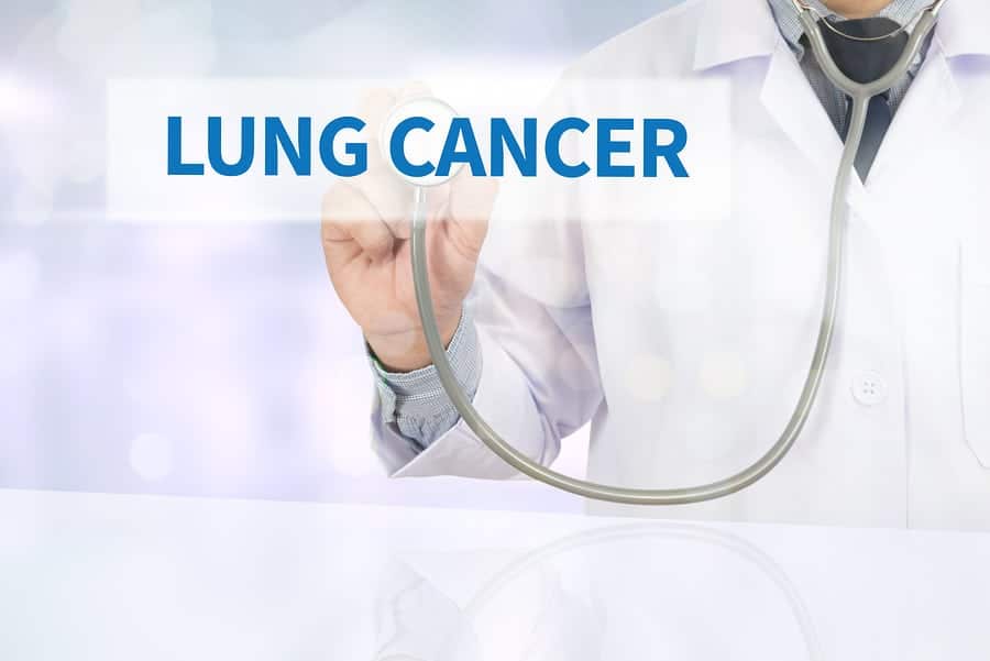 Elder Care in Elk Grove CA: Caring for a Loved One with Lung Cancer