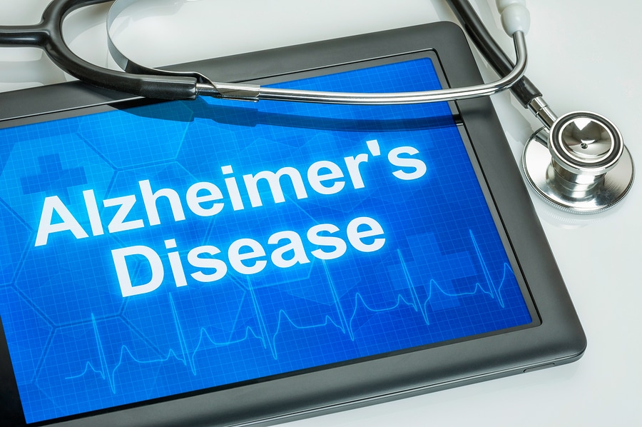 Senior Care in Elk Grove CA: Four Steps Towards Successful Alzheimer's Care