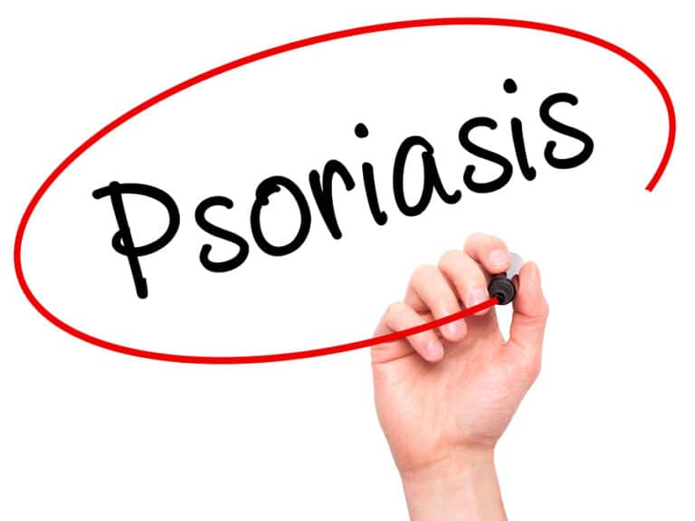 Home Care Davis, CA: Psoriasis
